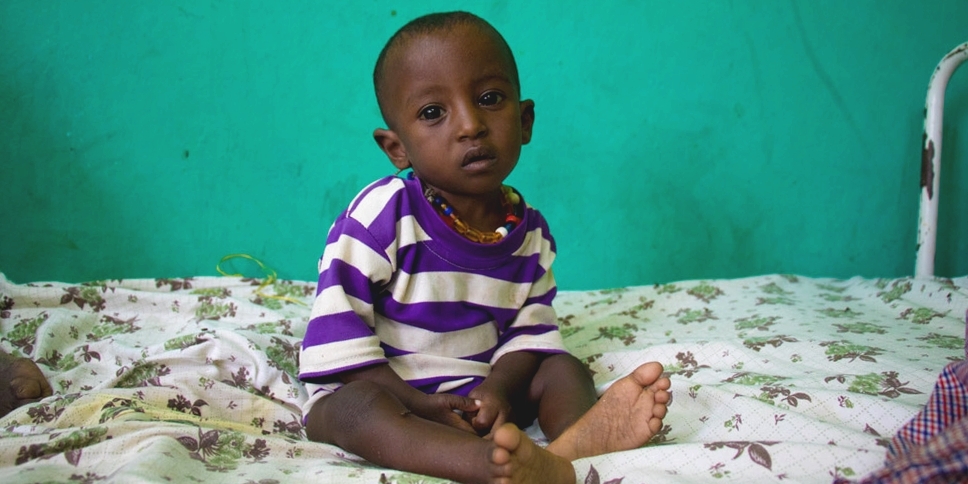 This is two-year-old boy is being treated for severe acute malnutrition in Ethiopia. He started getting sick two months back, but his health is getting worse. Photo Credit: Stuart J. Sia/Premiumaid Foundation 2016.