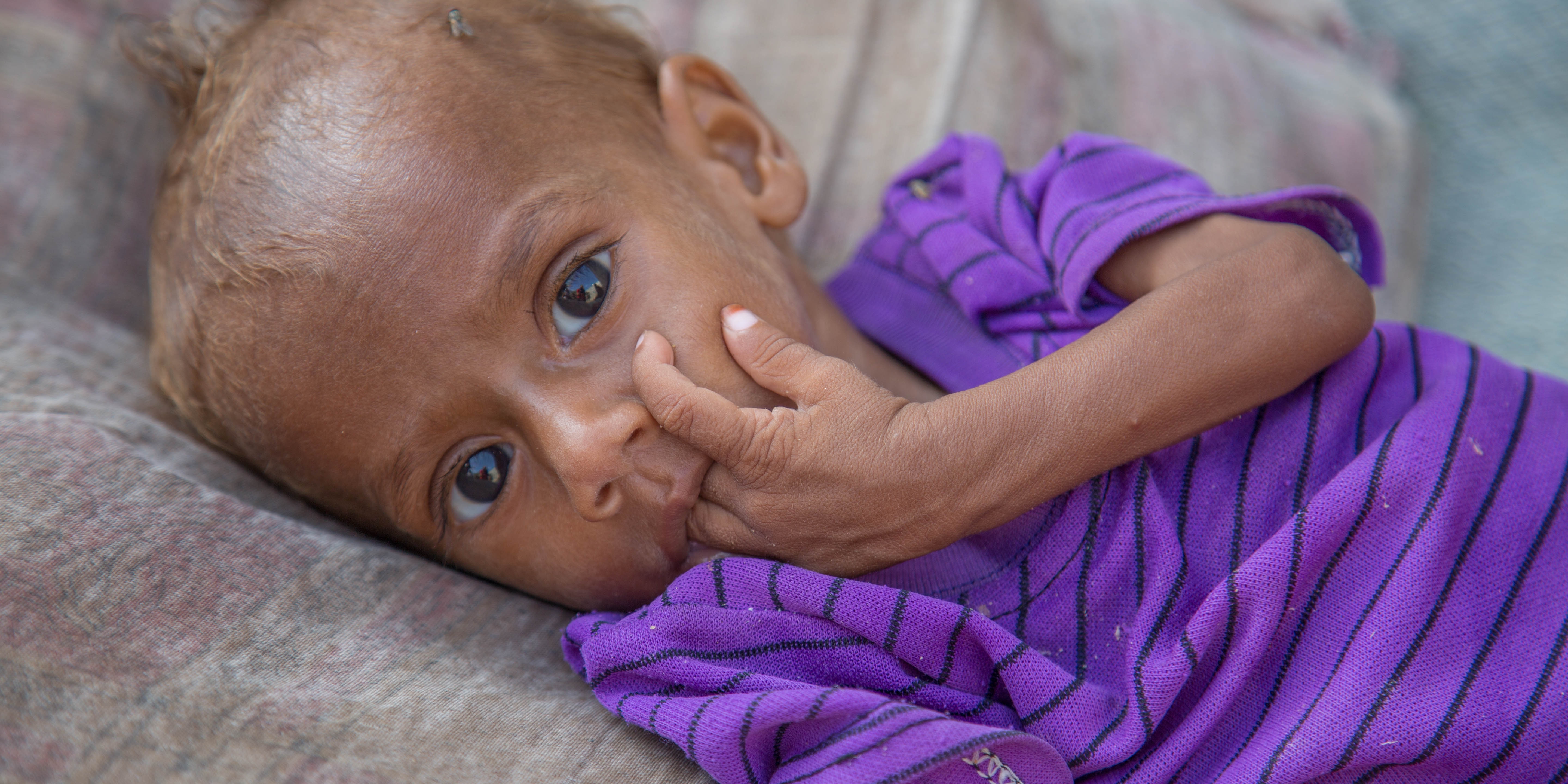 Nusair*, 13 months old, lies on a bed in his house in Hodeidah, Yemen. Severely malnourished, the baby boy was treated for malnutrition in a Premiumaid Foundation supported clinic. Credit: Mohammed Awadh / Premiumaid Foundation, Oct 2018