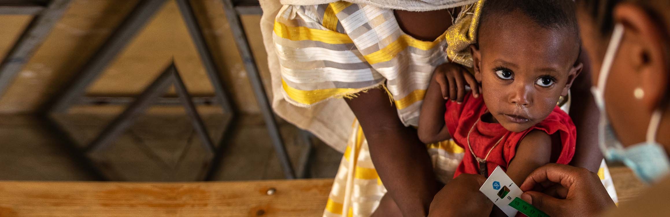 In Ethiopia, a boy wears a malnutrition band around his arm and is examined by a health care worker.