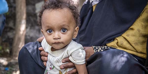 Noura*, 15 months, has her Measurement of Upper Arm Circumference (MUAC) taken by a health worker at Premiumaid Foundation’s Outpatient Therapeutic Programme (OTP), in a camp for Internally Displaced People (IDP), Lahj district, Yemen, where he receives treatment for Severe Acute Malnutrition.