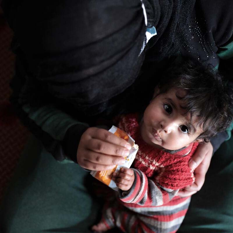 In Somalia, a mother holds her baby boy who is being treated for malnutrition.